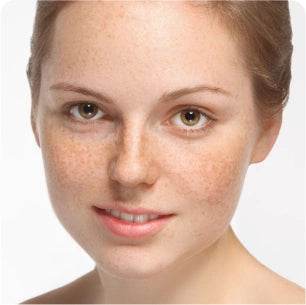 Skin Brightening & Pigmentations - passionindulge