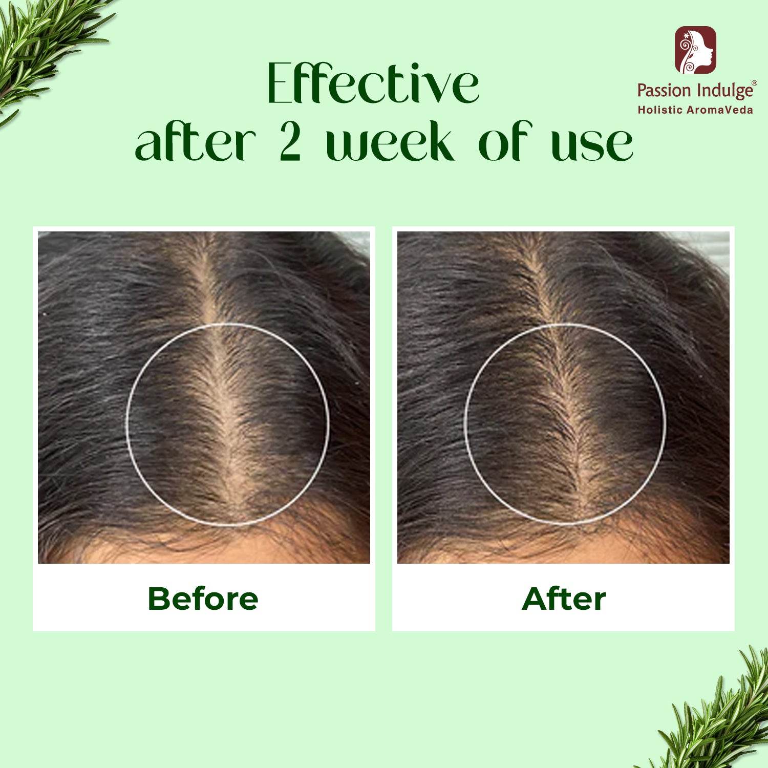 HAIR PROTEINZ Rosemary Hair Growth Oil with Biotin-100 ml , Stimulate hair growth, Control hair fall, Hair Breakage - passionindulge